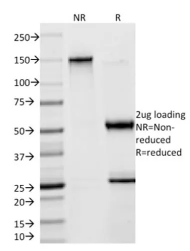 Anti-SOX9 / SRY-box 9 (SOX9/2398), CF640R conjugate - image 2
