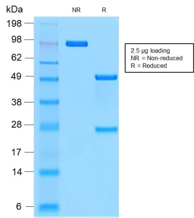 Anti-CD44v9 (Marker of Tumor Metastasis) (CD44v9/2344R), CF647 conjugate - image 2