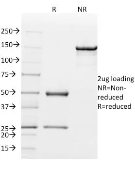 Anti-Mammaglobin (SCGB2A2) (Breast Cancer Marker) (MGB1/2000), CF647 conjugate - image 3