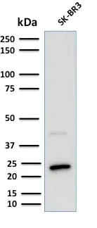 Anti-Mammaglobin (SCGB2A2) (Breast Cancer Marker) (MGB1/2000), CF647 conjugate - image 4