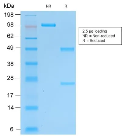 Anti-PGP9.5 / UchL1 (pan-Neuronal Marker) (rUCHL1/775), CF647 conjugate - image 2