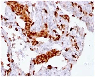 Anti-Napsin A (Lung Adenocarcinoma Marker) (rNAPSA/1239), CF647 conjugate - image 1