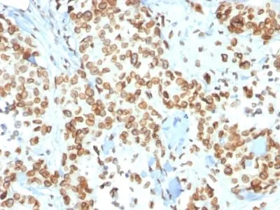 Anti-Emerin (Papillary Thyroid Carcinoma and EDMD Marker) (EMD/2167), CF647 conjugate - image 1