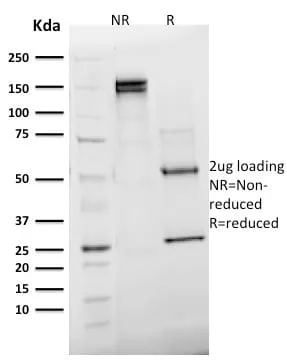 Anti-Emerin (Papillary Thyroid Carcinoma and EDMD Marker) (EMD/2168), CF647 conjugate - image 5