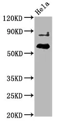Phospho-AKT1 (T450) Recombinant Monoclonal Antibody - image 1