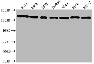 SMC1A Recombinant Monoclonal Antibody - image 1