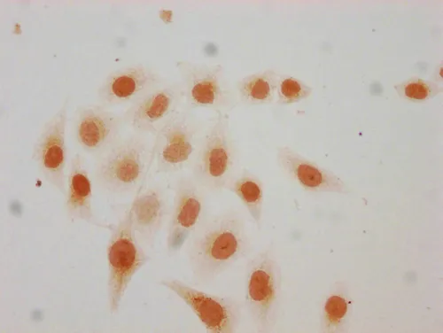 Acetyl-HIST1H3A (K115) Antibody - image 1