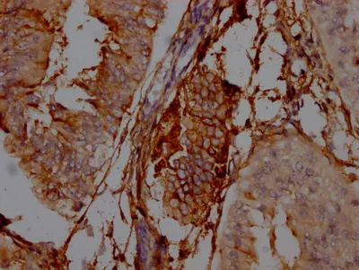 NT5E Recombinant Monoclonal Antibody - image 1