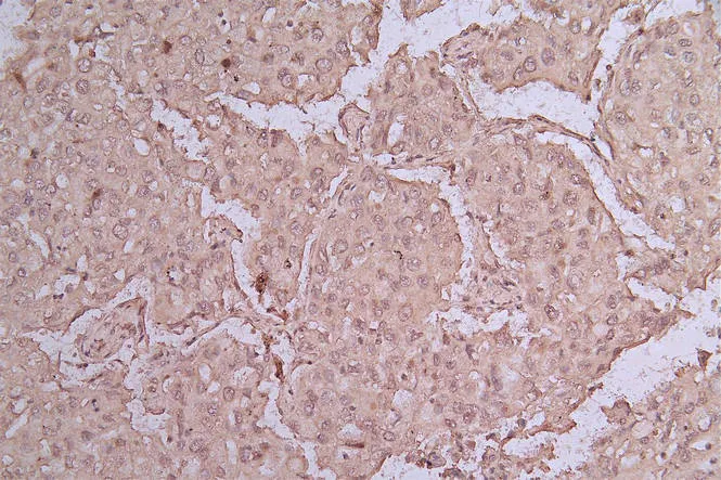 EGFR Recombinant Monoclonal Antibody - image 1