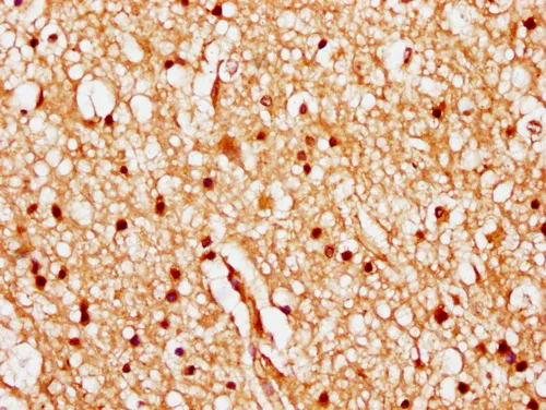 HIST1H1C (Ab-84) Antibody - image 1