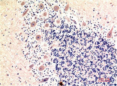 MAP1LC3B Monoclonal Antibody - image 1