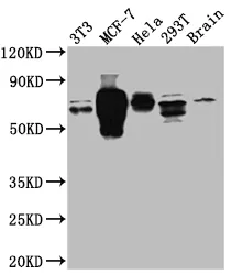 RPS6KB1 Recombinant Monoclonal Antibody - image 1