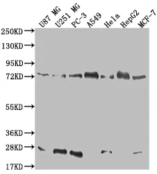 CAPN2 Recombinant Monoclonal Antibody - image 1
