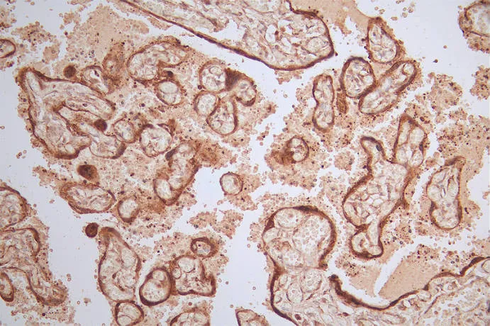 HSD3B1 Recombinant Monoclonal Antibody - image 1