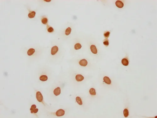 2-hydroxyisobutyryl-HIST1H2AG (K5) Antibody - image 1