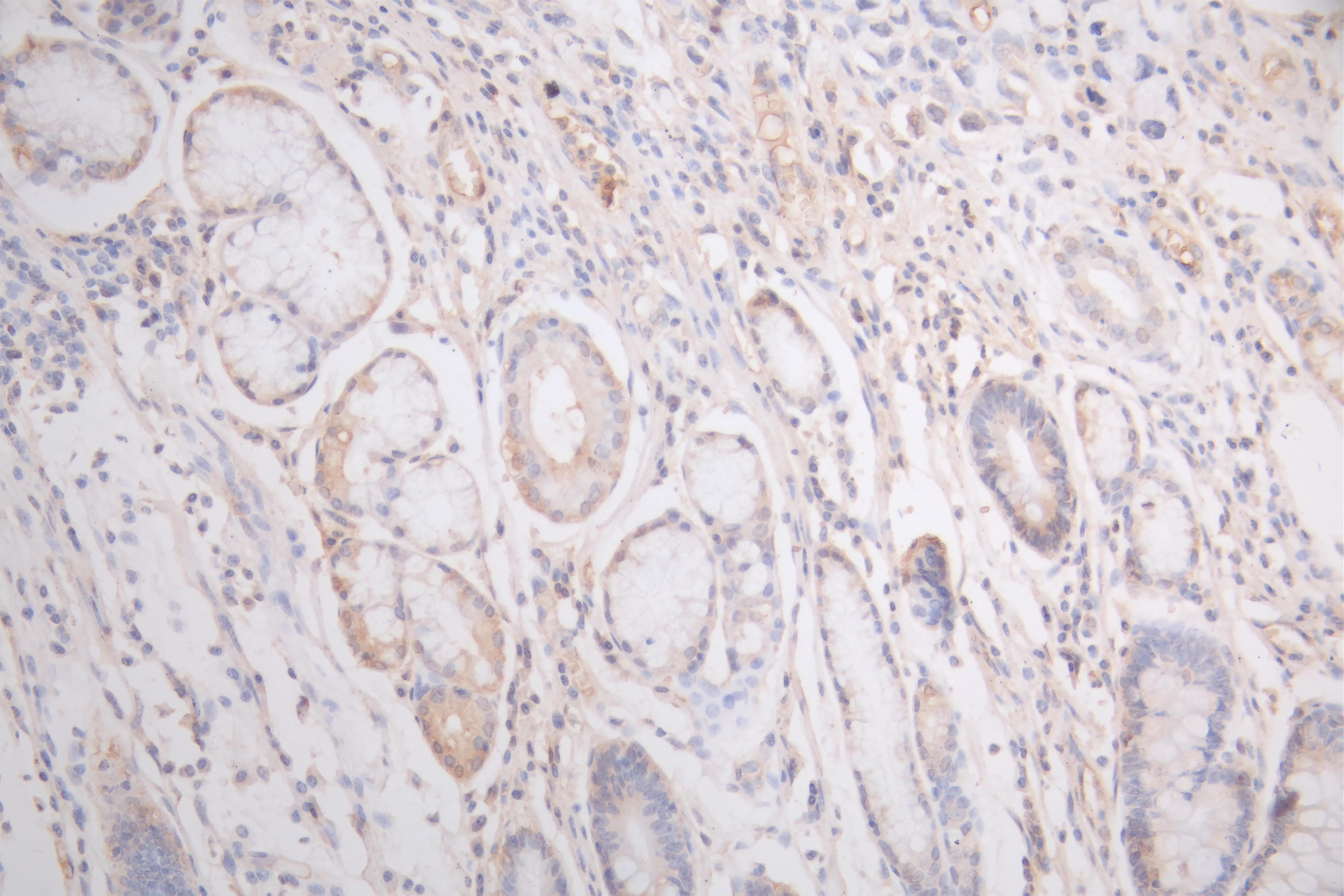 FLT1 Recombinant Monoclonal Antibody - image 1
