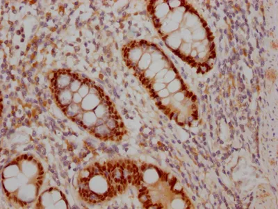 SOX9 Recombinant Monoclonal Antibody - image 1