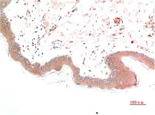 Phospho-SMAD3 (S425) Monoclonal Antibody - image 1