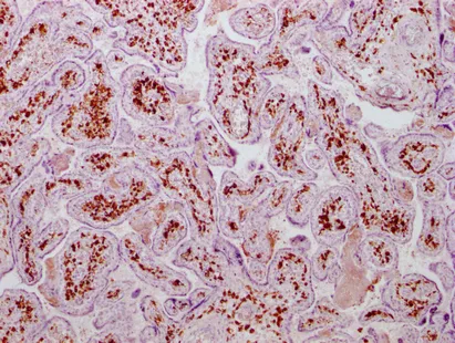 F13A1 Monoclonal Antibody - image 1