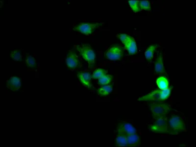 CXCR4 Recombinant Monoclonal Antibody - image 1