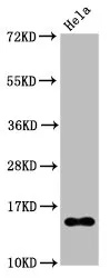 Acetyl-Histone H2B type 1-B (K20) Recombinant Monoclonal Antibody - image 1
