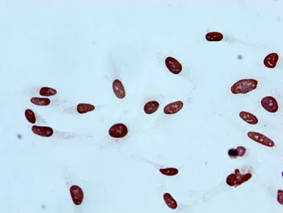 Acetyl-Histone H2B type 1-B (K20) Recombinant Monoclonal Antibody - image 2
