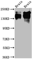 NTRK1 Recombinant Monoclonal Antibody - image 1