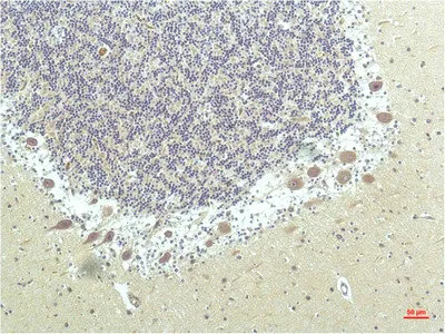 PPARD Monoclonal Antibody - image 1