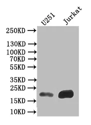 FTH1 Recombinant Monoclonal Antibody - image 1