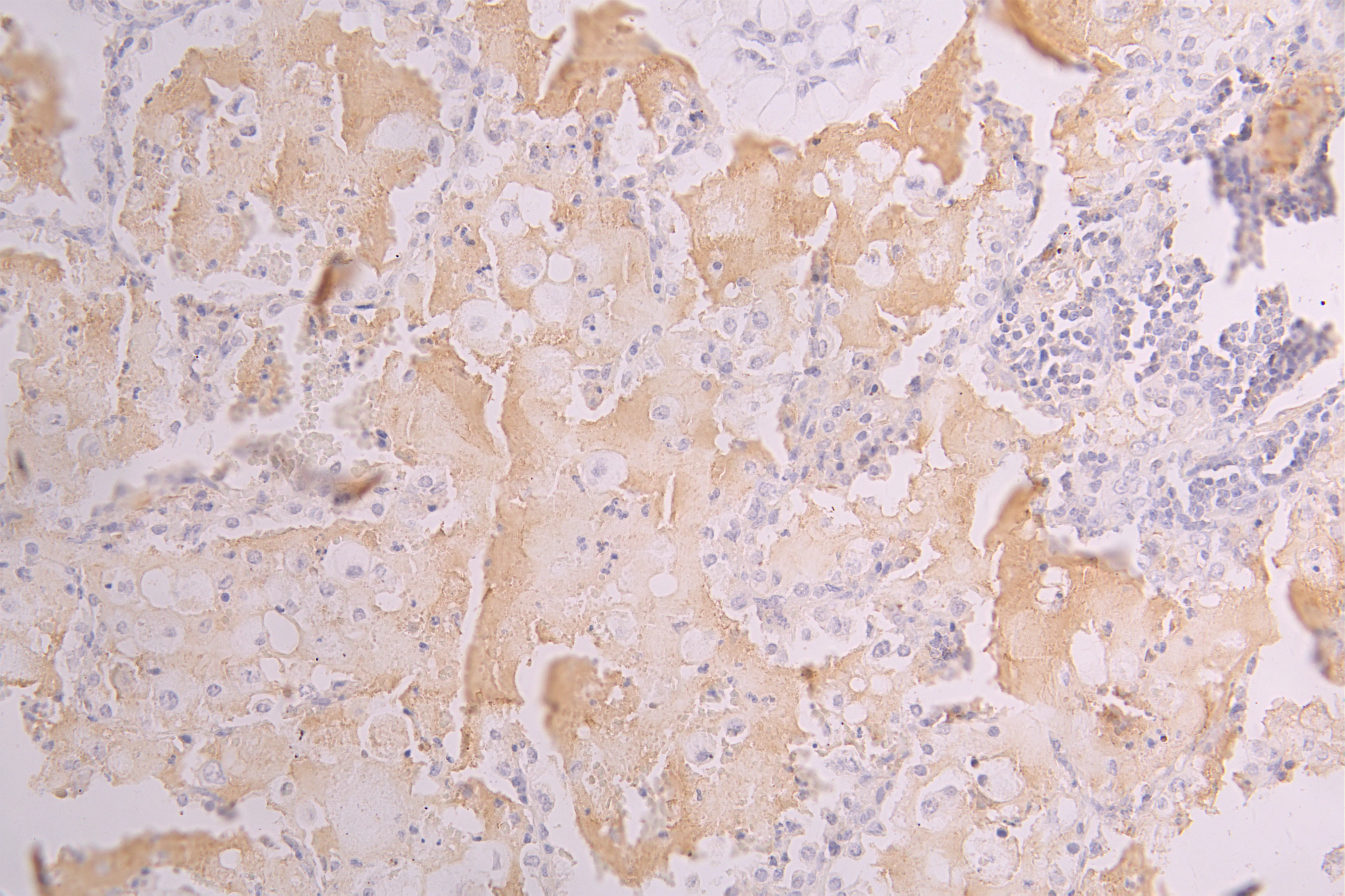 AOC3 Recombinant Monoclonal Antibody - image 1