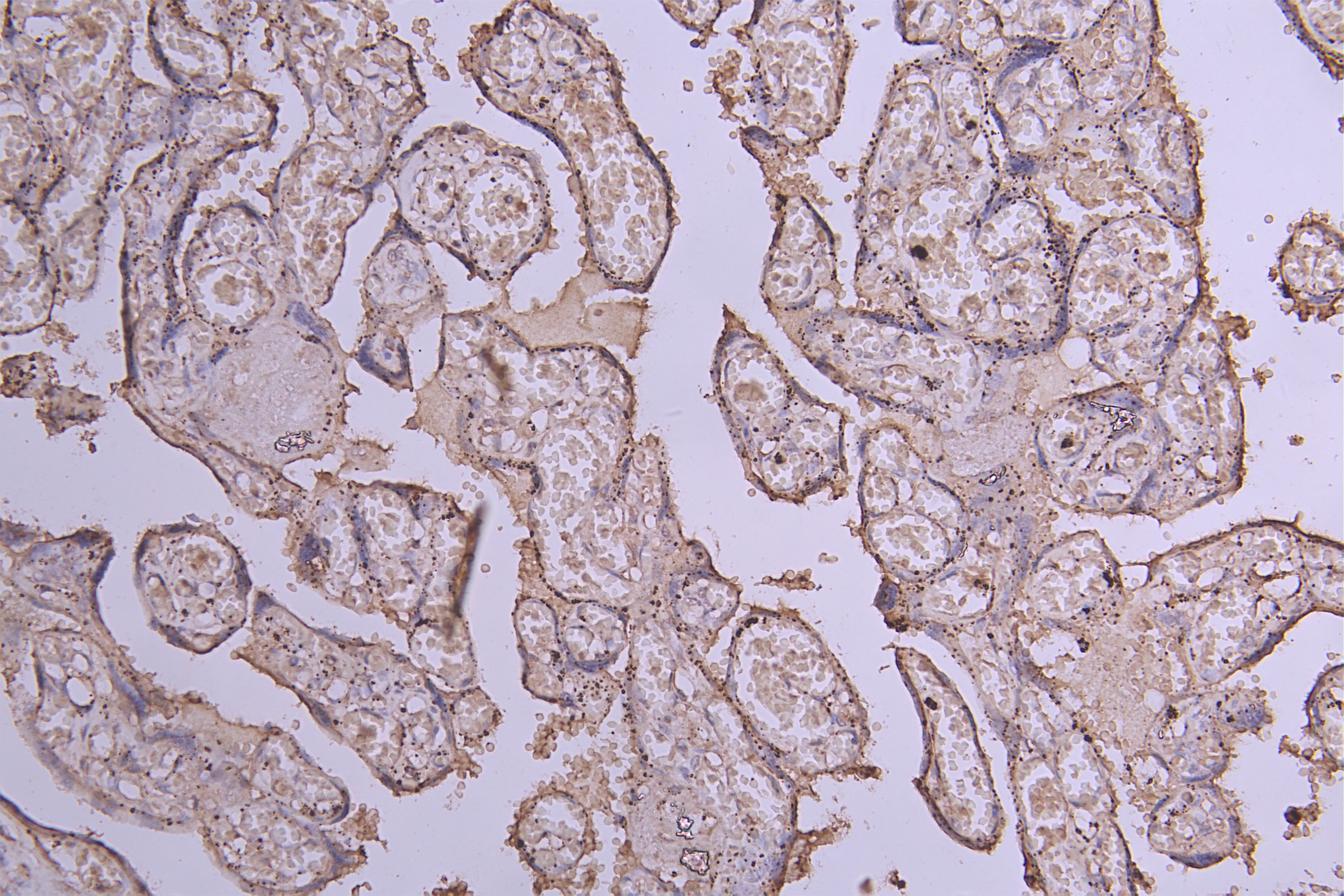 ENTPD1 Recombinant Monoclonal Antibody - image 1