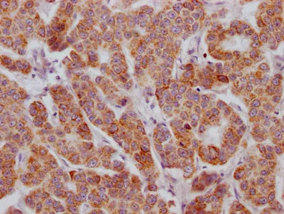 ACVR2B Recombinant Monoclonal Antibody - image 1