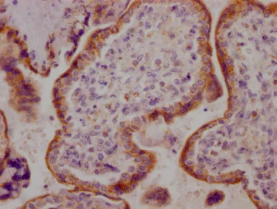 ACVR2B Recombinant Monoclonal Antibody - image 2