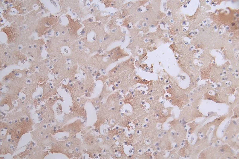 Phospho-MAPT (S404) Recombinant Monoclonal Antibody - image 1