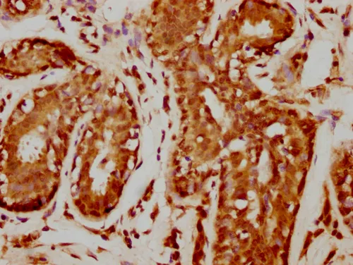 HIST1H1C (Ab-109) Antibody - image 1