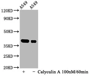 Phospho-NFKBIA (S32) Recombinant Monoclonal Antibody - image 1