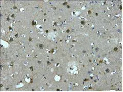 MAP2 Monoclonal Antibody - image 1