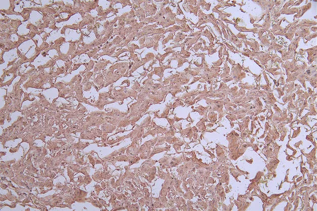 ARG1 Recombinant Monoclonal Antibody - image 1
