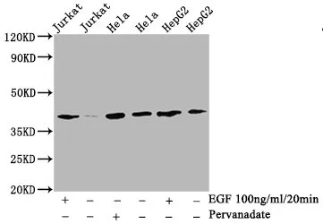 Phospho-LAT (Y191) Recombinant Monoclonal Antibody - image 1