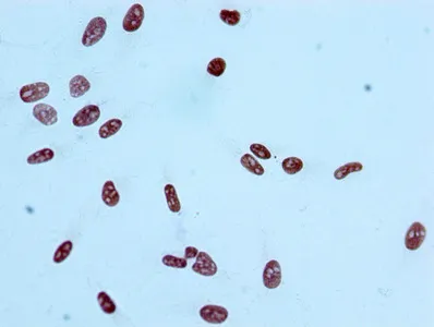 Acetyl-Histone H2A type 1-B/E (K9) Recombinant Monoclonal Antibody - image 1