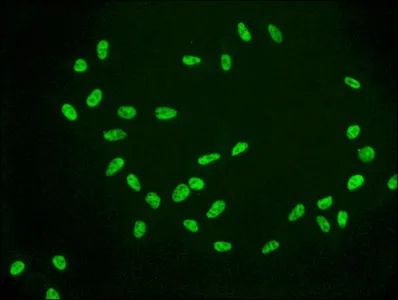 Acetyl-Histone H2A type 1-B/E (K9) Recombinant Monoclonal Antibody - image 2