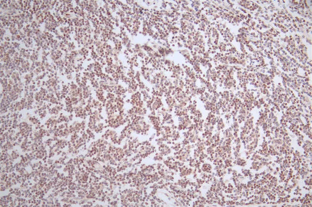 LEF1 Recombinant Monoclonal Antibody - image 1