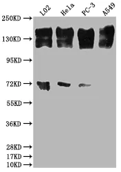 EGFR Recombinant Monoclonal Antibody - image 1