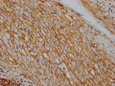 ATP1A1 Recombinant Monoclonal Antibody - image 1