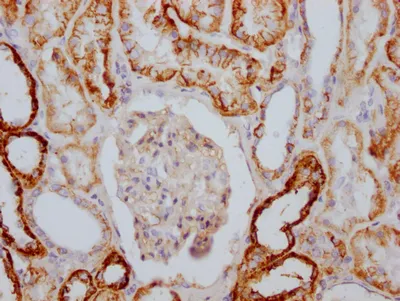ATP1A1 Recombinant Monoclonal Antibody - image 2