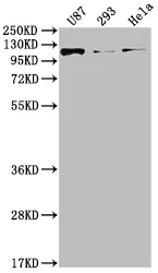 FGFR3 Recombinant Monoclonal Antibody - image 1