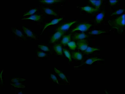 CCNE1 Recombinant Monoclonal Antibody - image 1