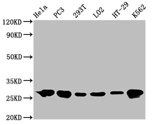HSPB1 Recombinant Monoclonal Antibody - image 1
