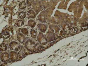 ACTA2 Monoclonal Antibody - image 1