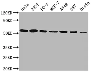 KLF4 Recombinant Monoclonal Antibody - image 1